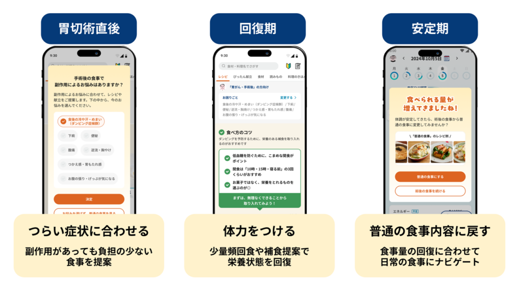 ヘルスケアスタートアップ「おいしい健康」 デジタルヘルスを用いた胃がん切除術患者の伴走支援に関する共同臨床研究を京都府立医科大学消化器外科と開始 〜アプリによる退院後の日常生活伴走を通じ、早期回復をサポート〜